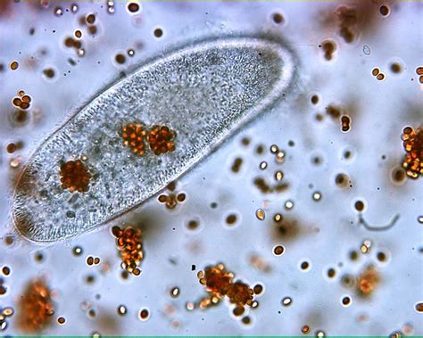 Paramecium! Een Microscopisch Wonder dat zich Beweegt met Trillingen en Voedt zich met Bacteriën