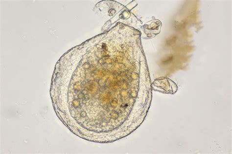   Arcella! Een microscopische meester van camouflage die zich voortplant door celdeling!