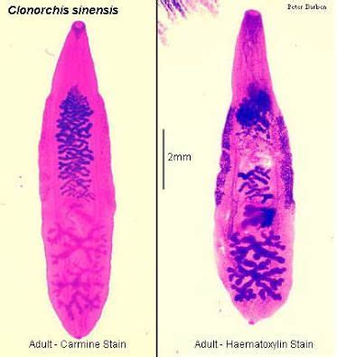  Japanse Clonorchis! Een Trematode Parasiet met een Voorkeur voor de Lever