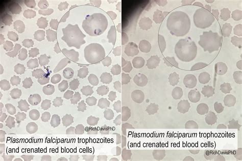  Plasmodium: Een microscopische meesterknecht die de cellen van zijn gastheer koloniseert!