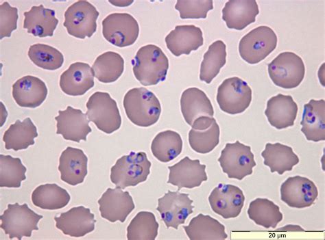  Plasmodium: Een Microscopische Meesterstrateeg die Rode Bloedlichamen als zijn Kasteel Gebruikt!